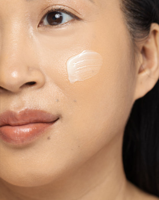 DERMA V